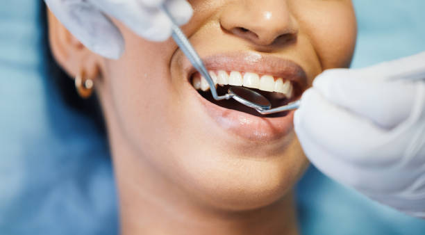 Best Emergency Dental Care for Broken or Chipped Teeth in Washburn, WI