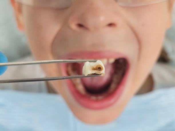 Best Pediatric Emergency Dentist in Washburn, WI